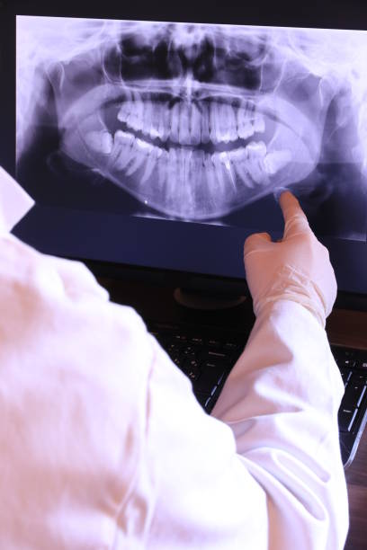 Best Emergency Tooth Extraction in Columbus Af, MS
