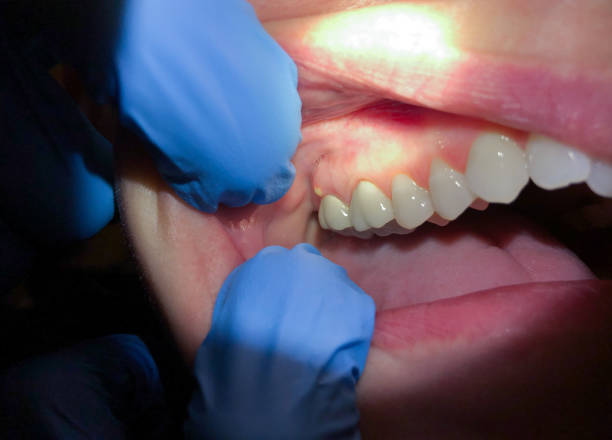 Best Emergency Treatment for Toothache in Columbus Af, MS