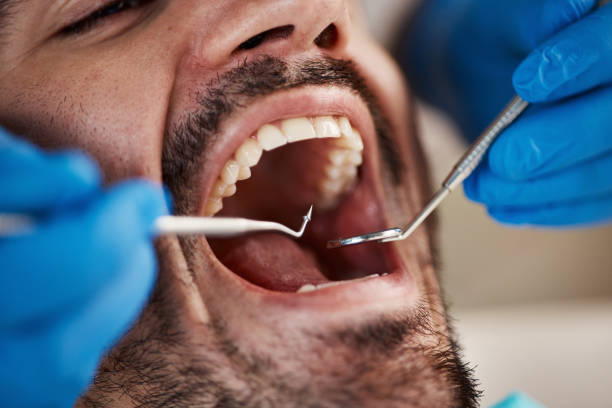 Best Urgent Dental Care in Columbus Af, MS